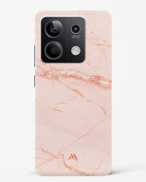 Rose Quartz on Marble Hard Case Phone Cover (Xiaomi)