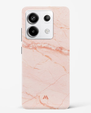 Rose Quartz on Marble Hard Case Phone Cover (Xiaomi)