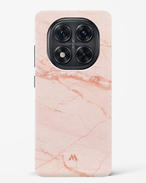 Rose Quartz on Marble Hard Case Phone Cover (Xiaomi)