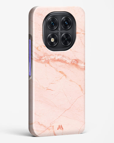 Rose Quartz on Marble Hard Case Phone Cover (Xiaomi)