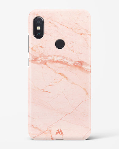 Rose Quartz on Marble Hard Case Phone Cover (Xiaomi)