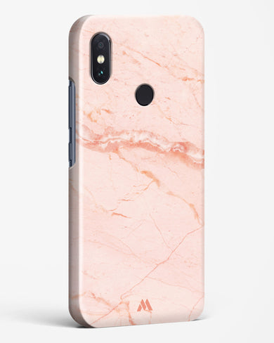 Rose Quartz on Marble Hard Case Phone Cover (Xiaomi)