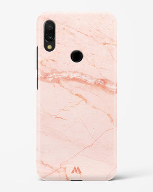 Rose Quartz on Marble Hard Case Phone Cover (Xiaomi)