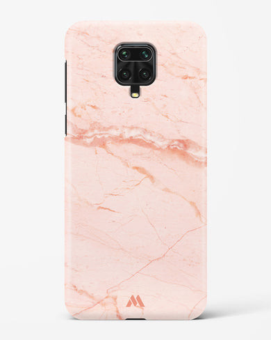 Rose Quartz on Marble Hard Case Phone Cover (Xiaomi)