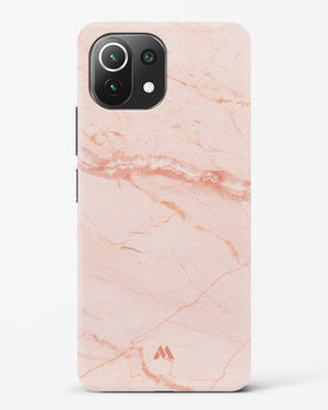 Rose Quartz on Marble Hard Case Phone Cover (Xiaomi)