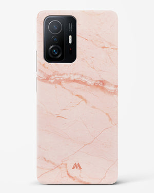 Rose Quartz on Marble Hard Case Phone Cover (Xiaomi)
