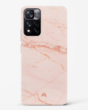 Rose Quartz on Marble Hard Case Phone Cover (Xiaomi)