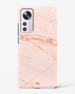 Rose Quartz on Marble Hard Case Phone Cover (Xiaomi)
