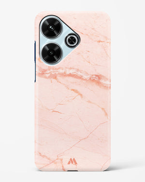 Rose Quartz on Marble Hard Case Phone Cover (Xiaomi)