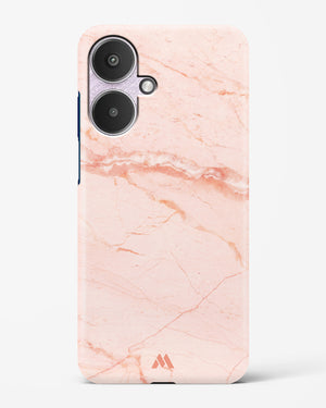 Rose Quartz on Marble Hard Case Phone Cover (Xiaomi)