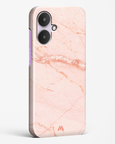 Rose Quartz on Marble Hard Case Phone Cover (Xiaomi)