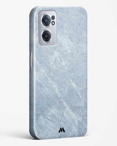 Picasso Grey Marble Hard Case Phone Cover (OnePlus)