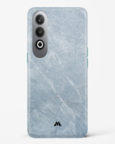 Picasso Grey Marble Hard Case Phone Cover (OnePlus)