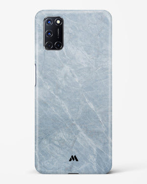 Picasso Grey Marble Hard Case Phone Cover-(Oppo)