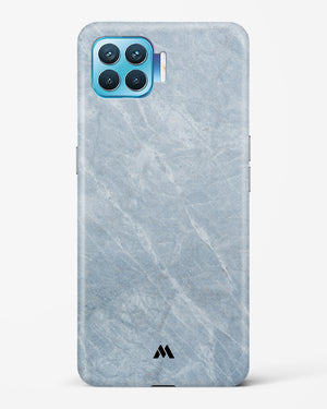 Picasso Grey Marble Hard Case Phone Cover-(Oppo)