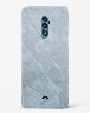 Picasso Grey Marble Hard Case Phone Cover-(Oppo)