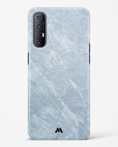 Picasso Grey Marble Hard Case Phone Cover-(Oppo)