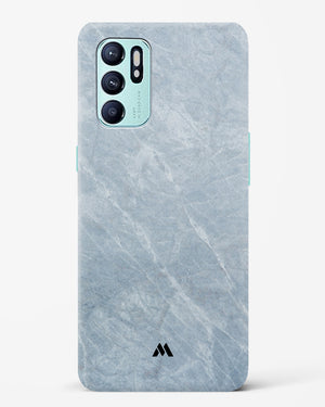 Picasso Grey Marble Hard Case Phone Cover-(Oppo)