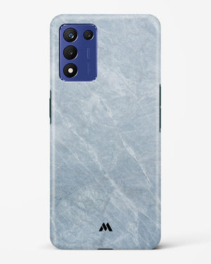 Picasso Grey Marble Hard Case Phone Cover-(Realme)