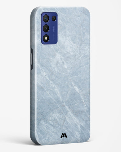 Picasso Grey Marble Hard Case Phone Cover (Realme)