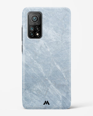 Picasso Grey Marble Hard Case Phone Cover (Xiaomi)
