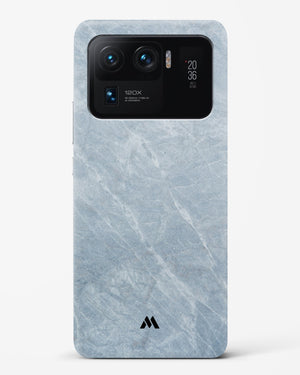 Picasso Grey Marble Hard Case Phone Cover (Xiaomi)
