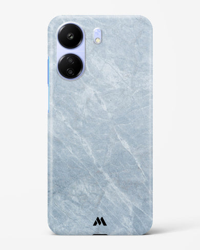 Picasso Grey Marble Hard Case Phone Cover (Xiaomi)