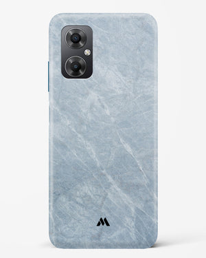 Picasso Grey Marble Hard Case Phone Cover (Xiaomi)