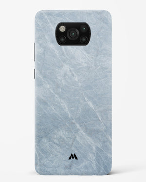 Picasso Grey Marble Hard Case Phone Cover-(Xiaomi)