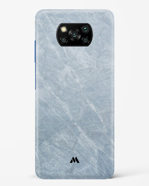 Picasso Grey Marble Hard Case Phone Cover-(Xiaomi)