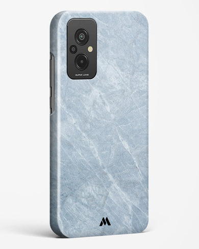 Picasso Grey Marble Hard Case Phone Cover (Xiaomi)