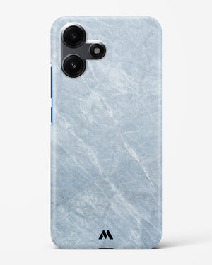 Picasso Grey Marble Hard Case Phone Cover (Xiaomi)