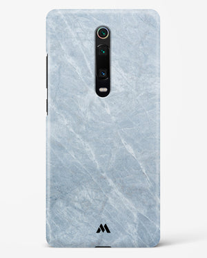 Picasso Grey Marble Hard Case Phone Cover (Xiaomi)