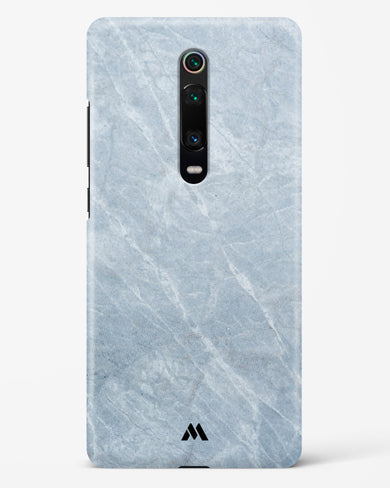 Picasso Grey Marble Hard Case Phone Cover-(Xiaomi)