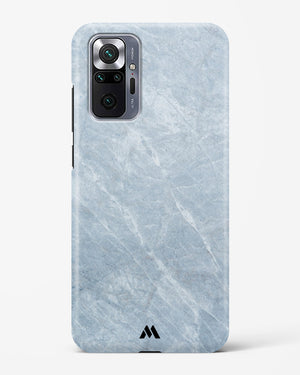 Picasso Grey Marble Hard Case Phone Cover (Xiaomi)