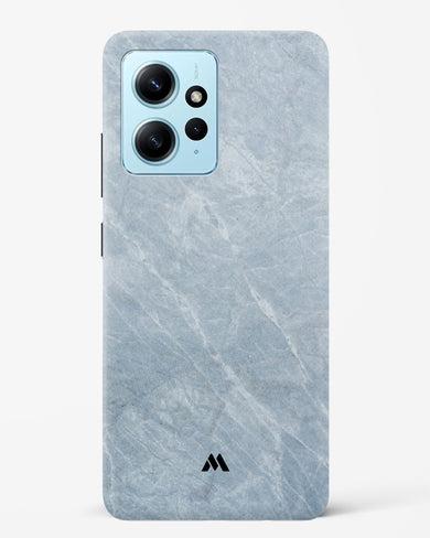 Picasso Grey Marble Hard Case Phone Cover (Xiaomi)