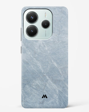 Picasso Grey Marble Hard Case Phone Cover (Xiaomi)
