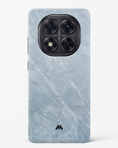 Picasso Grey Marble Hard Case Phone Cover (Xiaomi)