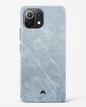 Picasso Grey Marble Hard Case Phone Cover-(Xiaomi)