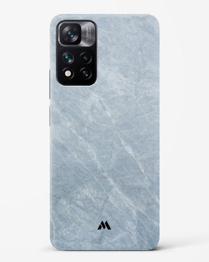 Picasso Grey Marble Hard Case Phone Cover-(Xiaomi)