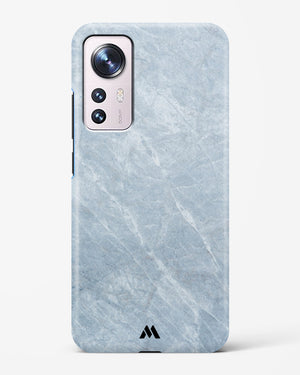 Picasso Grey Marble Hard Case Phone Cover-(Xiaomi)