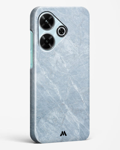 Picasso Grey Marble Hard Case Phone Cover (Xiaomi)