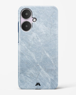 Picasso Grey Marble Hard Case Phone Cover (Xiaomi)