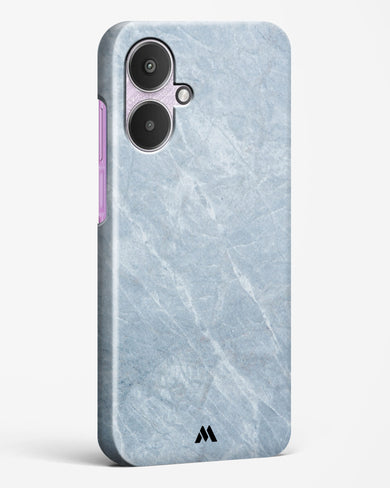 Picasso Grey Marble Hard Case Phone Cover (Xiaomi)