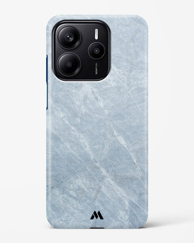 Picasso Grey Marble Hard Case Phone Cover (Xiaomi)