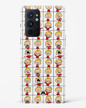 Calvin Making Faces Hard Case Phone Cover (OnePlus)