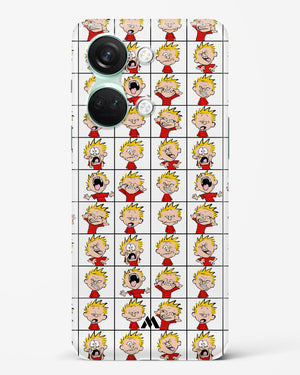 Calvin Making Faces Hard Case Phone Cover (OnePlus)