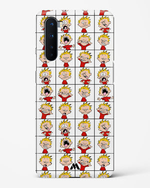 Calvin Making Faces Hard Case Phone Cover-(OnePlus)