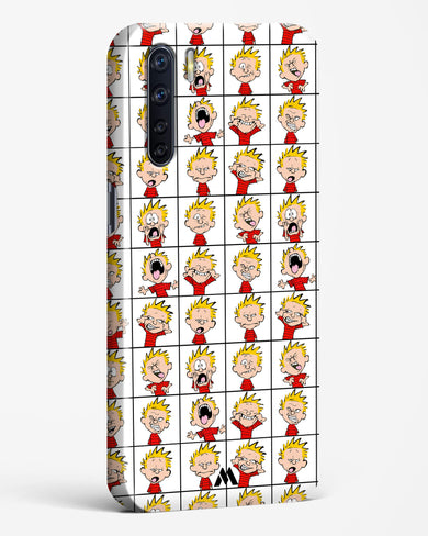 Calvin Making Faces Hard Case Phone Cover (Oppo)