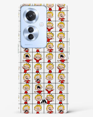 Calvin Making Faces Hard Case Phone Cover (Oppo)